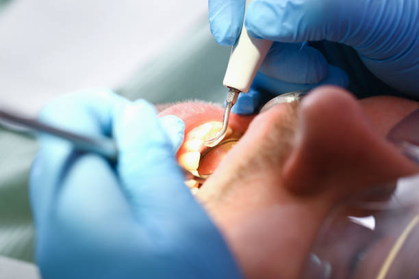 Best Urgent Dental Care for Toothache in Greenwich, OH